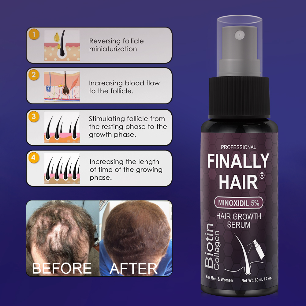 thumbnail image 2 of 2025 Biotin Premium Hair Growth Serum Spray – Thickening Treatment For Thicker, Healthier Hair, Unisex 2 of 5