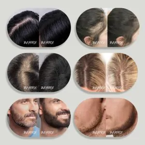 minute hair 10g发际线粉图 8