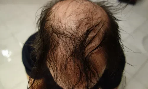 Screenshot_4-r5um4vwyz2pteot03jcf3p163wdbvjwf1cmy020s6w Screenshot_4-r5um4vwyz2pteot03jcf3p163wdbvjwf1cmy020s6w